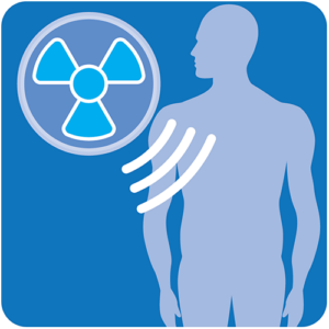 Icon for lung cancer radiotherapy