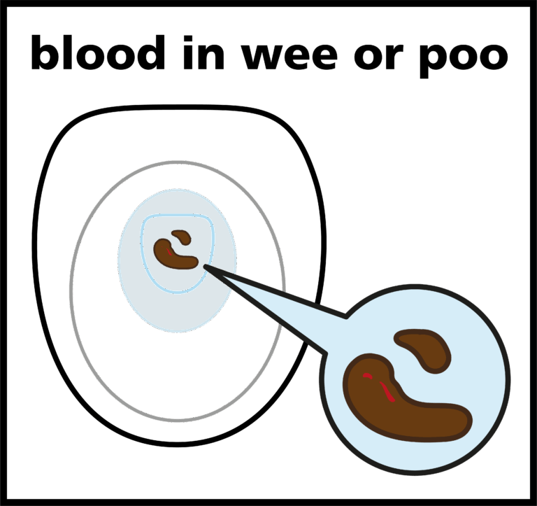 illustration of poo with blood on in a toilet