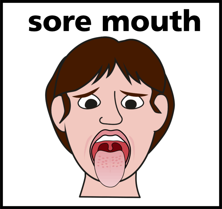 image of a person with tongue out showing their sore mouth
