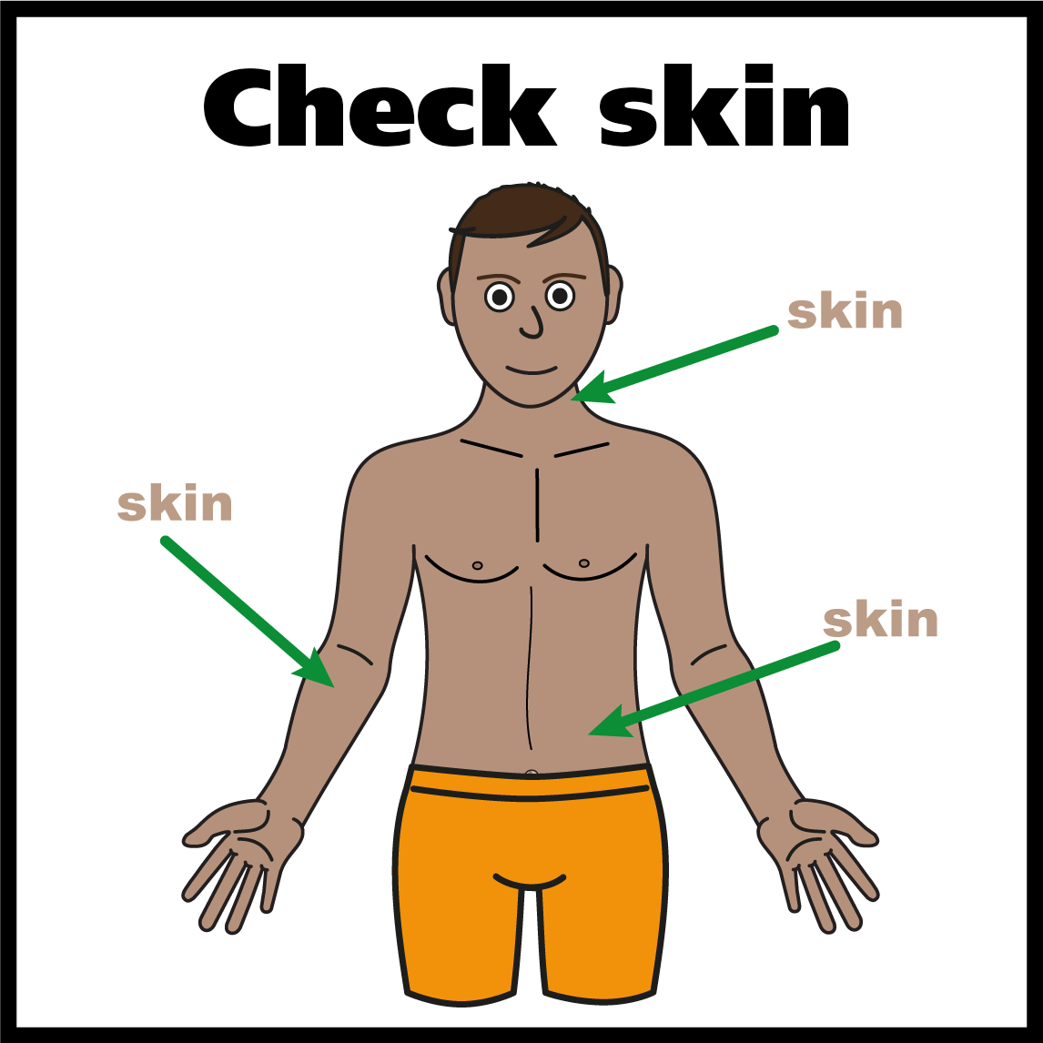 Picture with arrows indicating where to check your skin