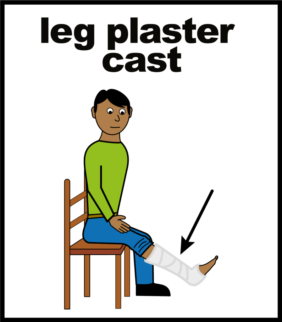 Illustration of a person with a plaster cast on their leg.