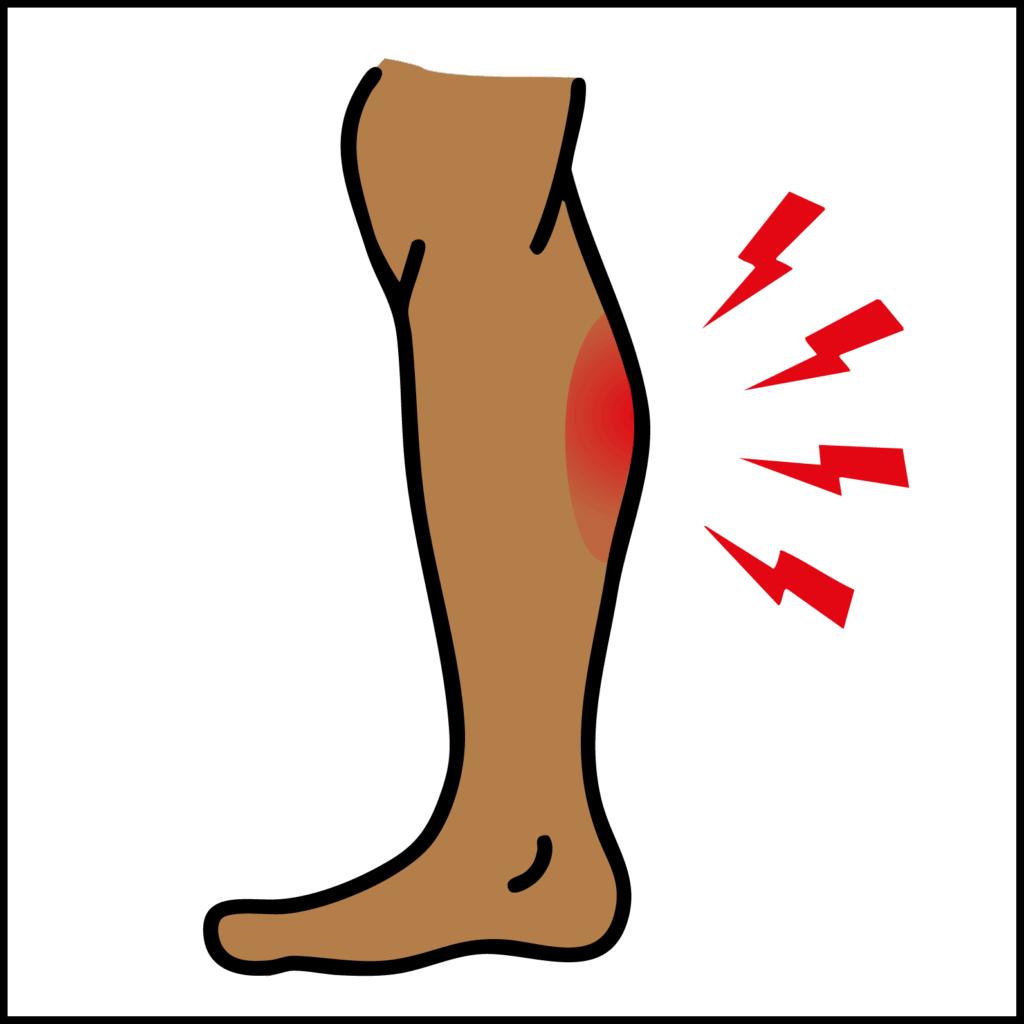 Illustration showing an area on a leg that is swollen and painful