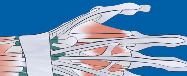Anatomical illustration showing thumb extensor tendon