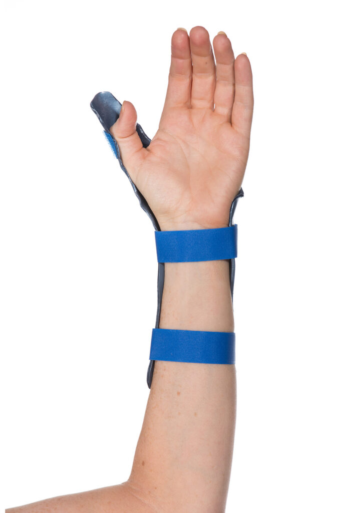Image shows thumb being flexed away from the splint into the palm of same hand