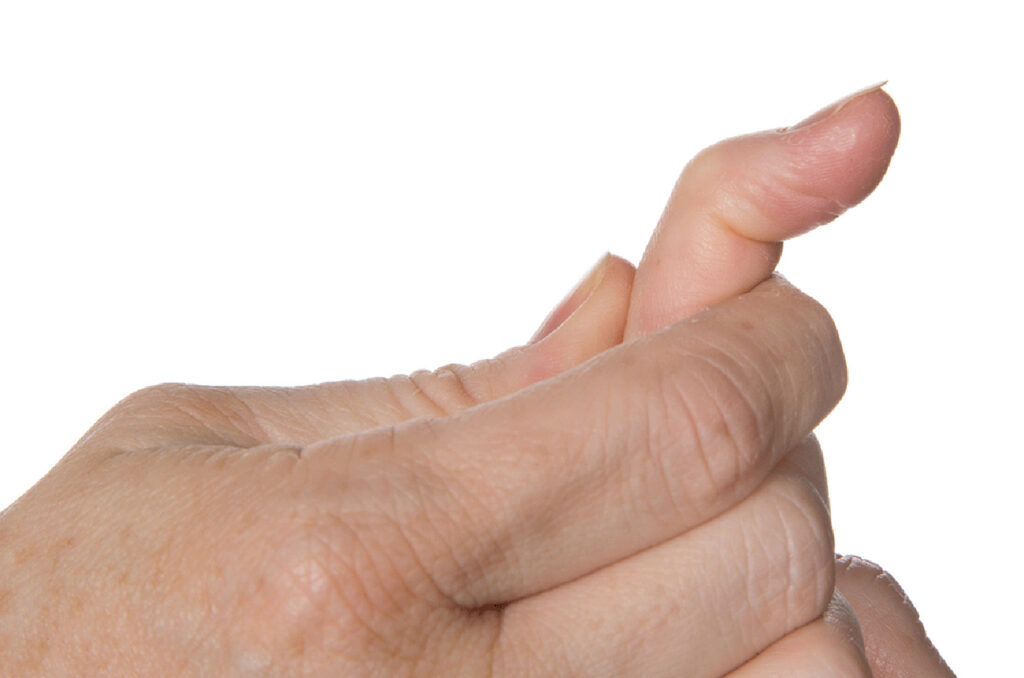 Support the affected finger at the middle joint then bend and straighten the end joint on its own.