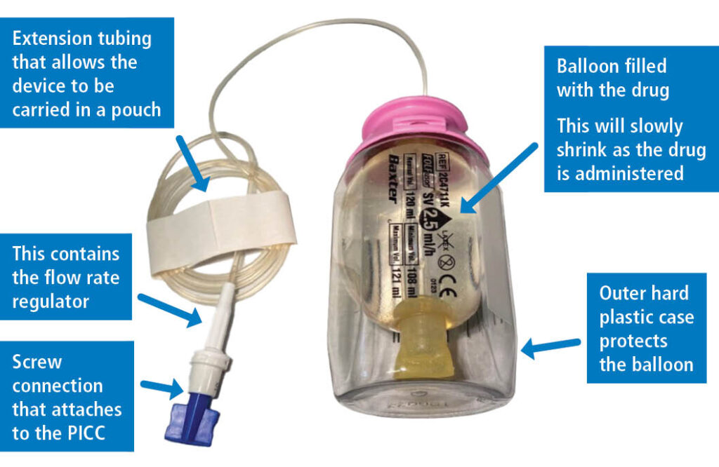 Image of infusion device with labelled parts