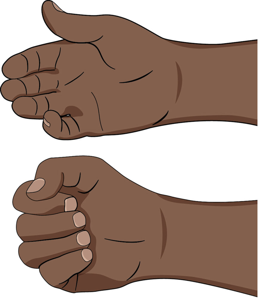 Illustration shows how to reduce the swelling in your wrist or hand by squeezing and pumping the swelling out of your hand by curling your fingers into your palm, as if you are going to make a fist, and then straightening them out again.