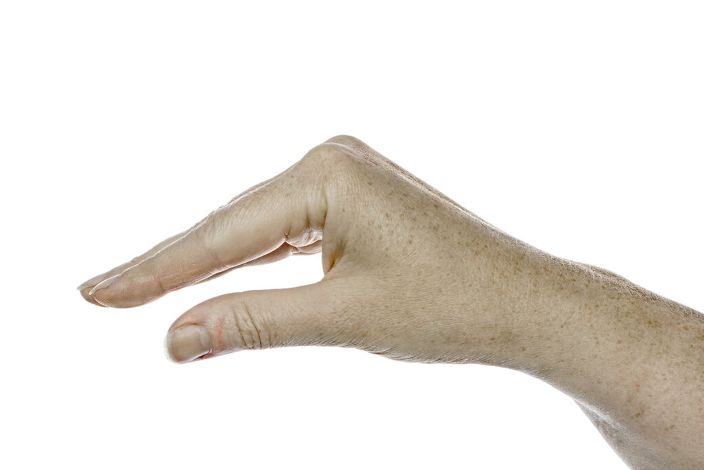 Elbow resting on a table, fingers bent at the knuckles, finger joints straight