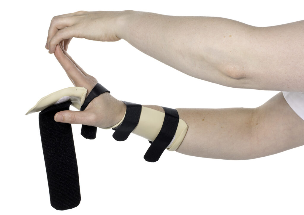 Picture shows other hand lifting fingers up and away from the splint.
