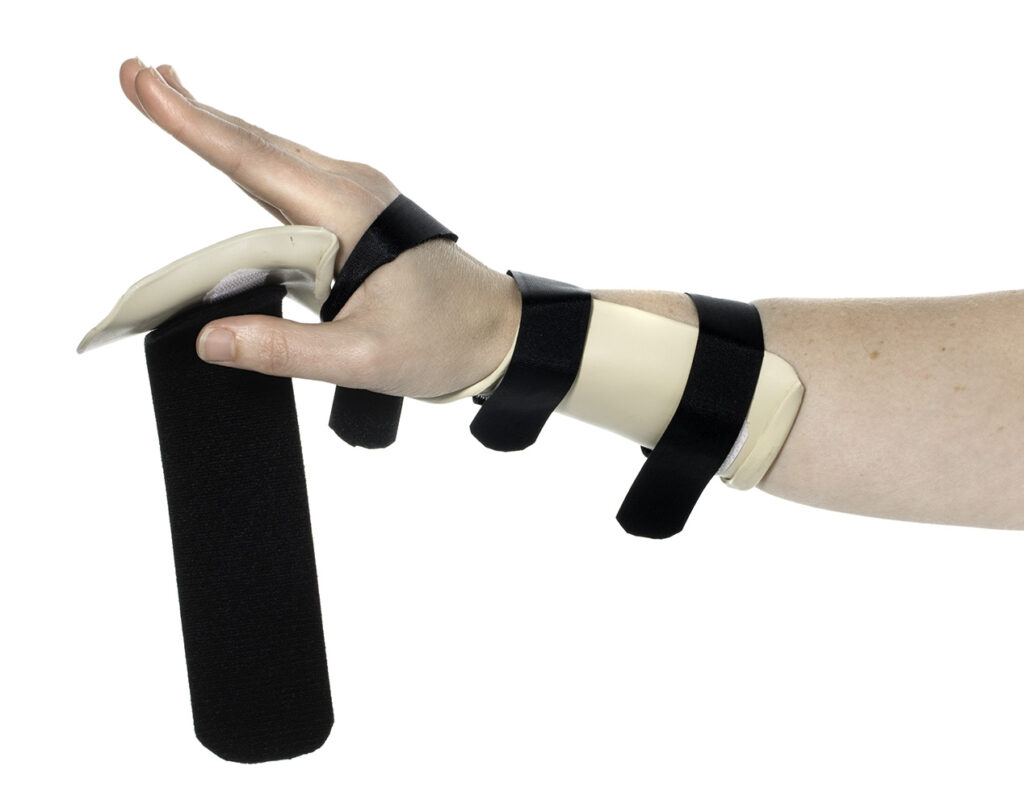 Picture shows how to actively straighten your fingers away from the splint