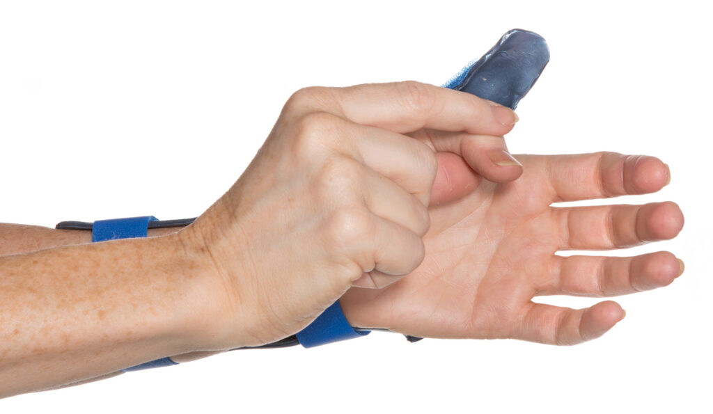 Image shows other hand gently bending the operated thumb into the palm of your hand