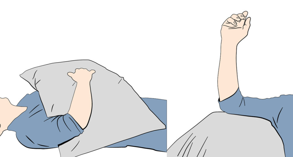 Illustration demonstrates how resting your arm on cushions with the hand above the elbow or on the back of a chair helps reduce swelling and stiffness by keeping your hand above the level of your heart.