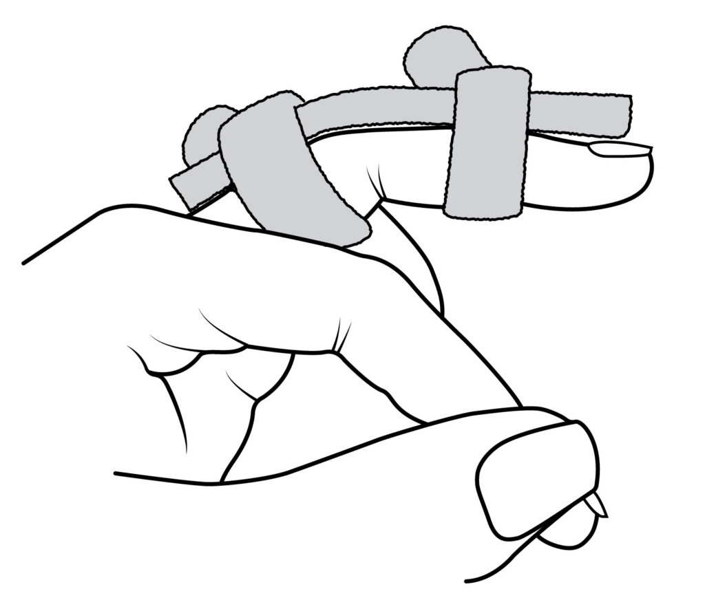 Image shows splint fitted to the back of the finger