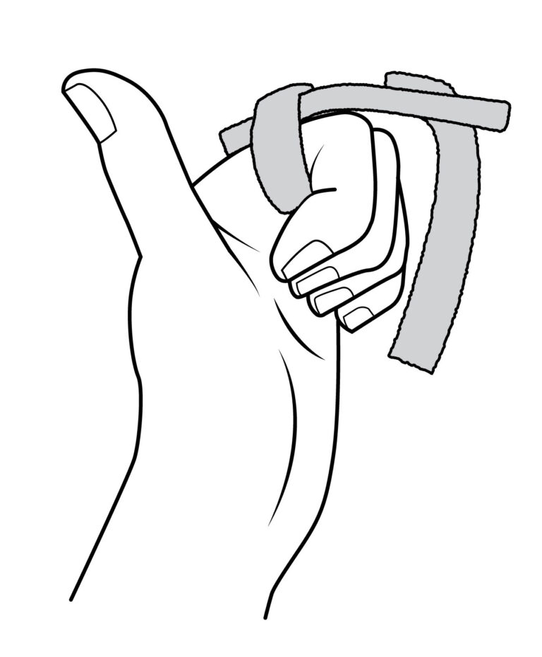 Image shows a loose top Velcro strap. The strap around the bottom of the finger stays fastened. Fingertip of the injured finger, is bent towards the palm to try to make a fist.
