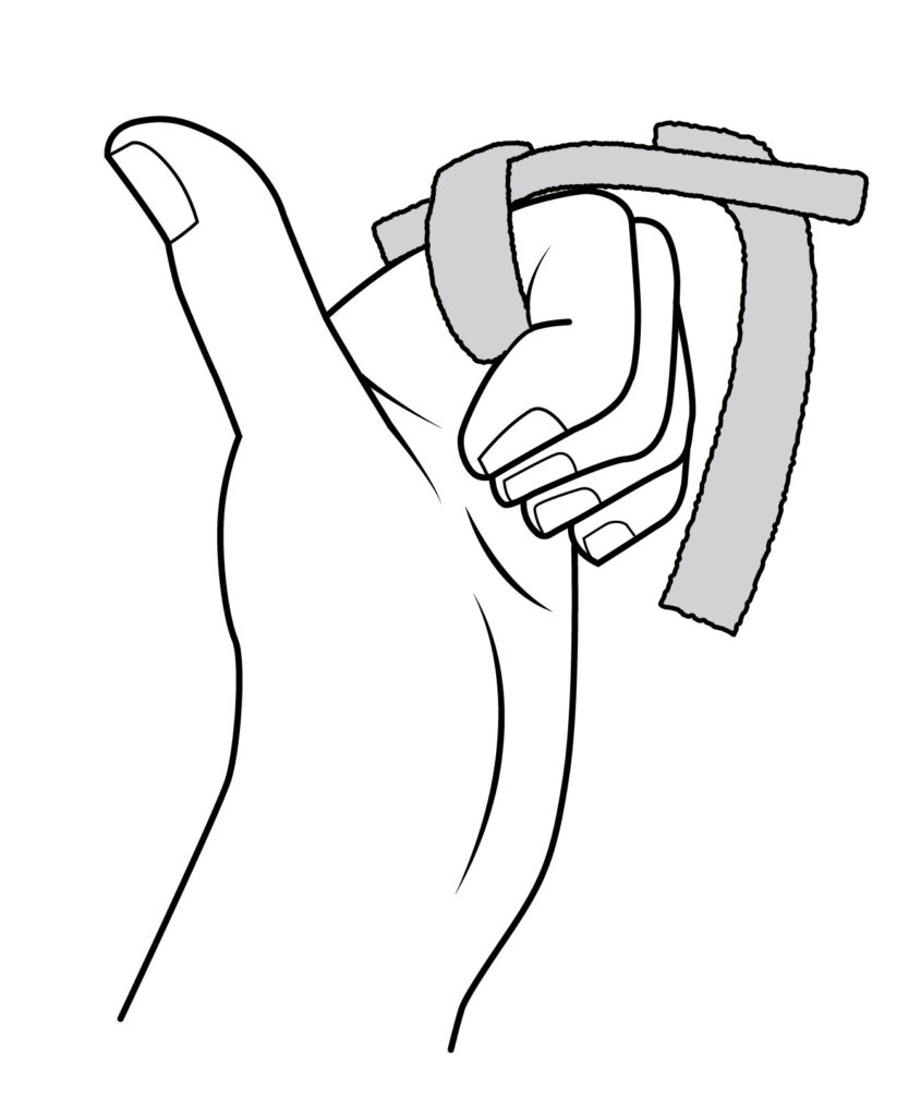 Image shows a loose top Velcro strap. The strap around the bottom of the finger stays fastened. Fingertip of the injured finger, is bent towards the palm to try to make a fist.