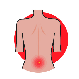 illustration showing a sore or pus filled spot on the lower back