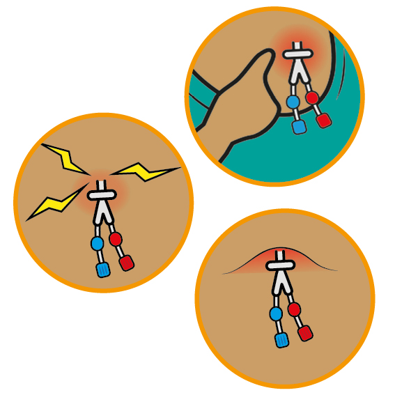 Illustration showing 3 possible types of infection, itching, pain and a lump.
