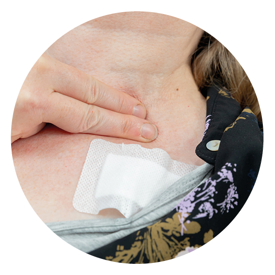 Photo showing pressure being applied to persons neck after a renal line has been pulled out.