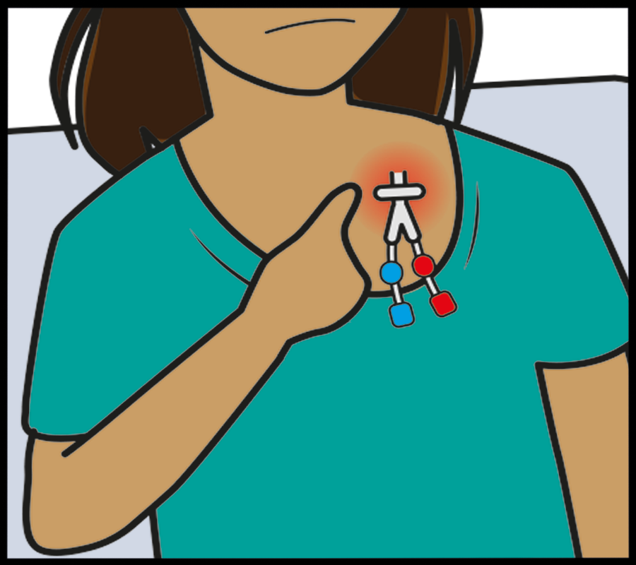 image of a sore, itchy or infected dialysis line site