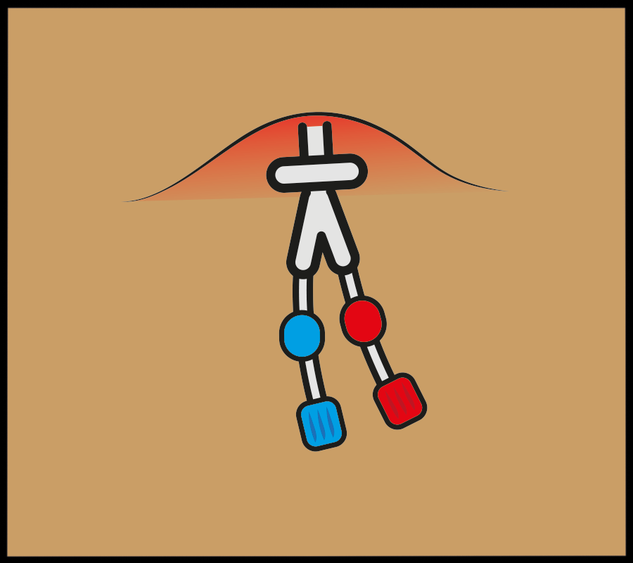 image of dialysis line with bump on the skin