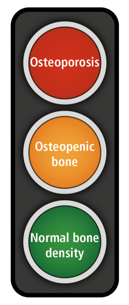 Bone health traffic light diagram